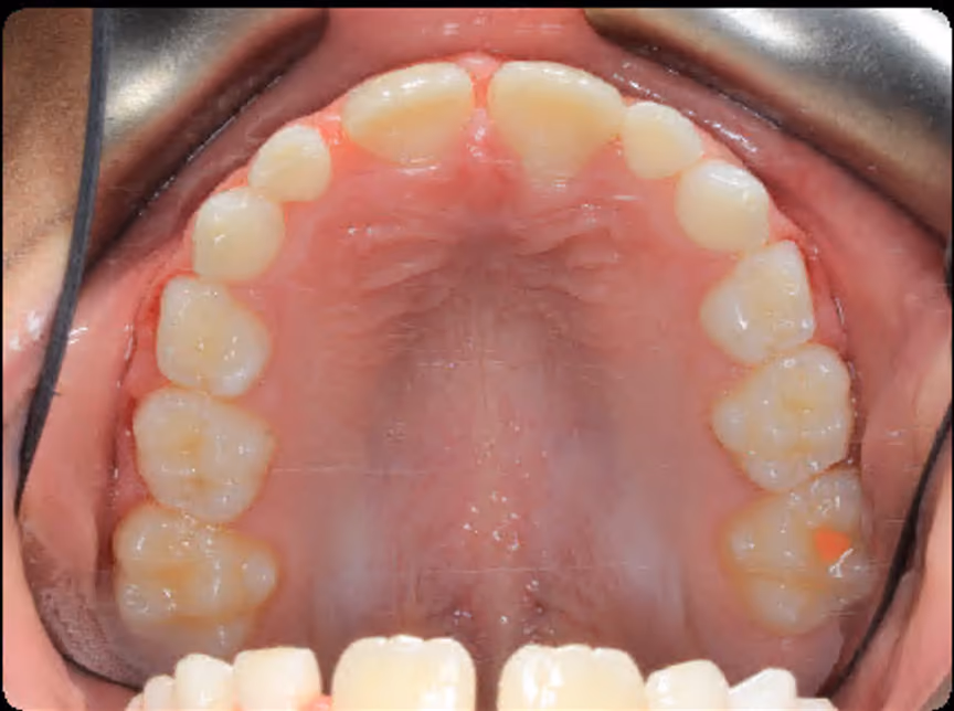 After Image