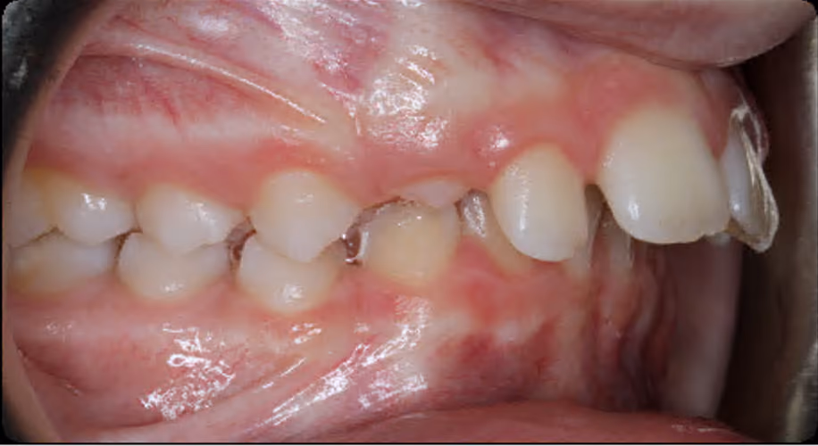 Before Image