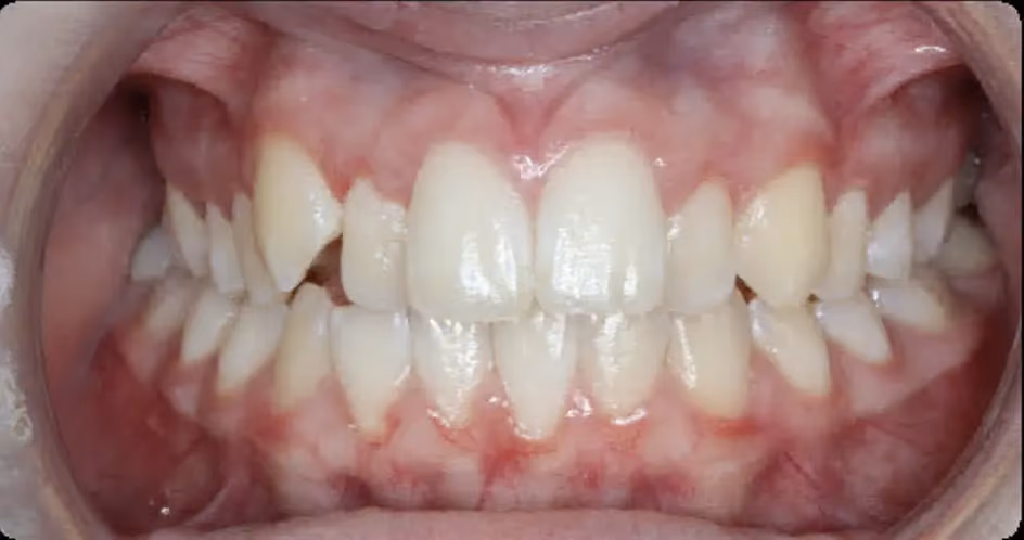 Before Image