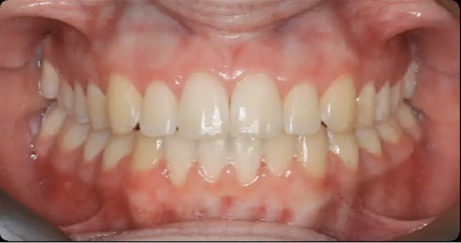 After Image