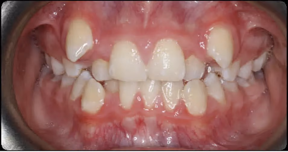 Before Image