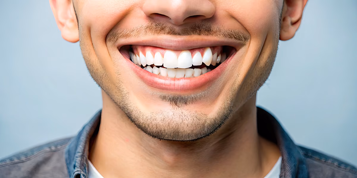 Open Bite Treatments