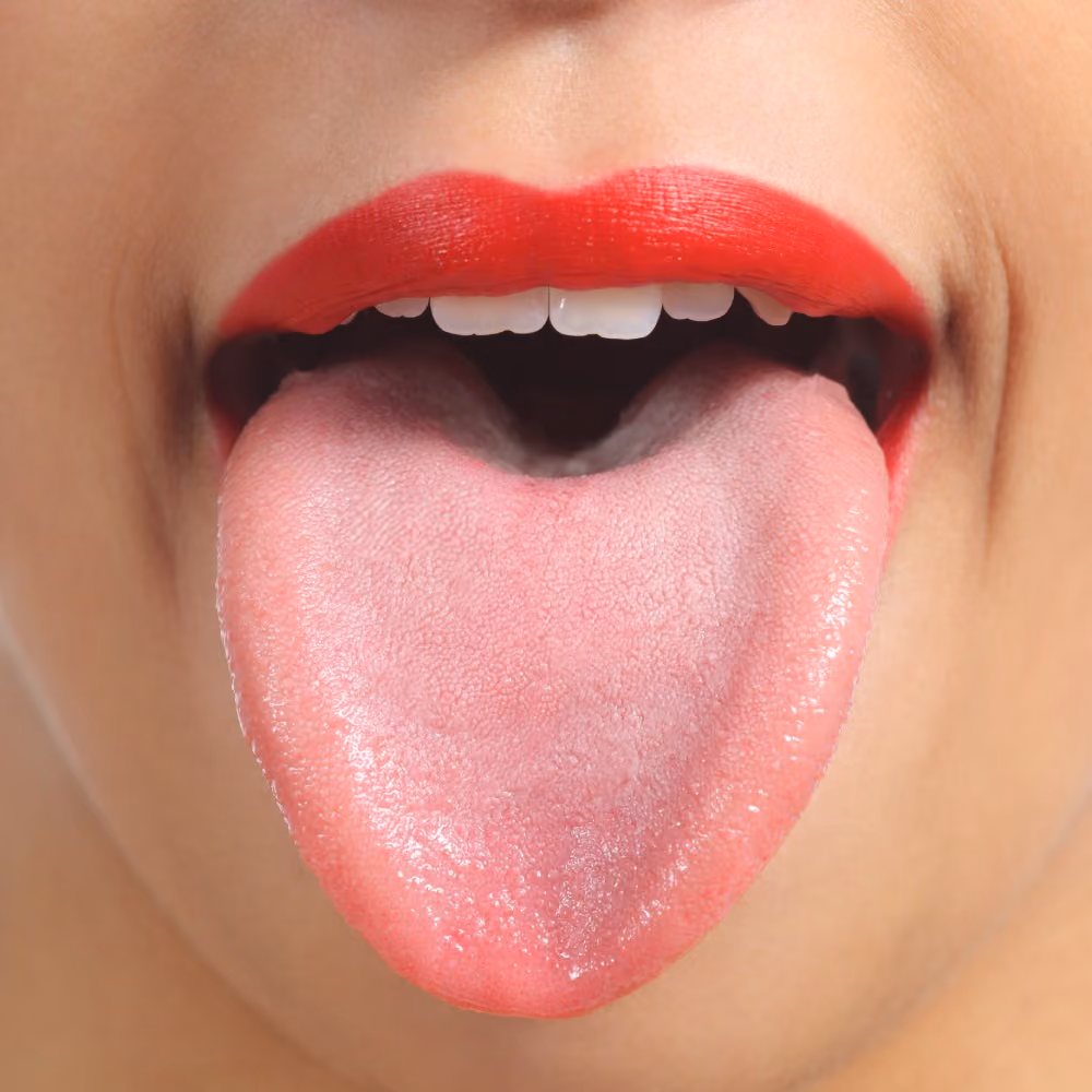 Tongue Thrust Treatment