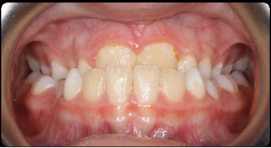 Before Image