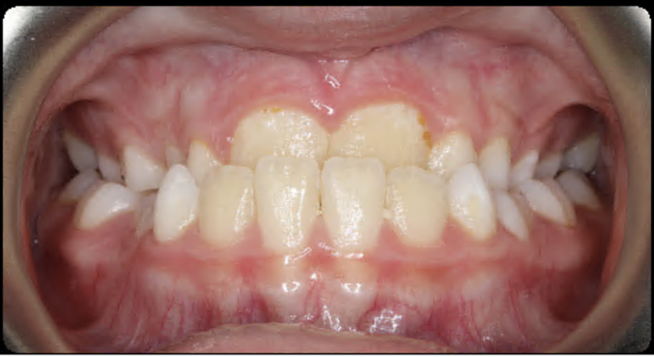 Before Image