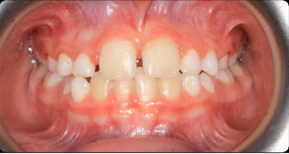 After Image