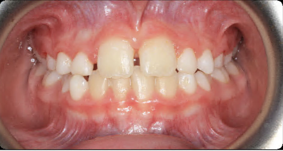 After Image