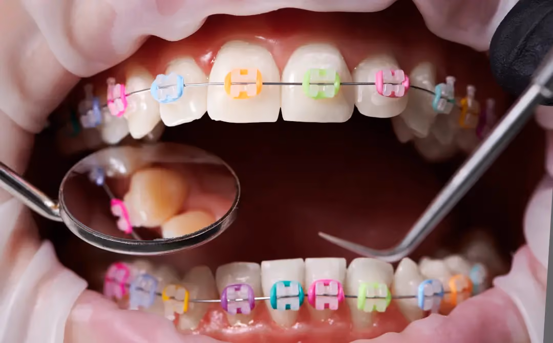 Teen Orthodontics