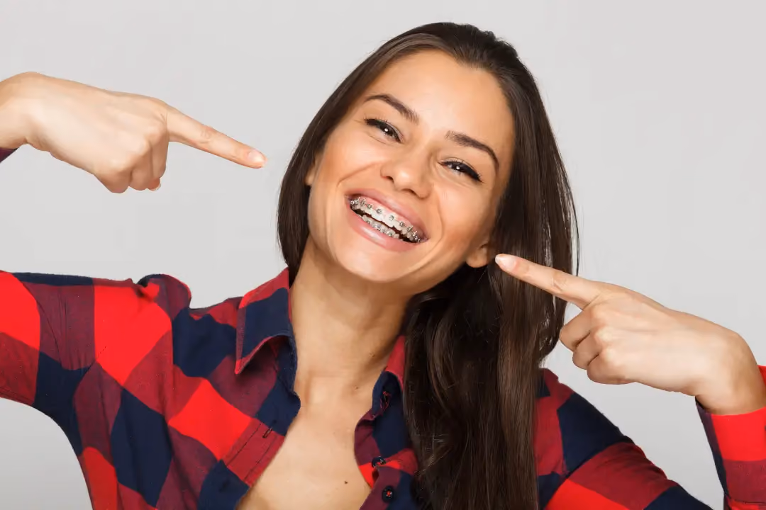 Does Insurance Cover Braces in Lutz?