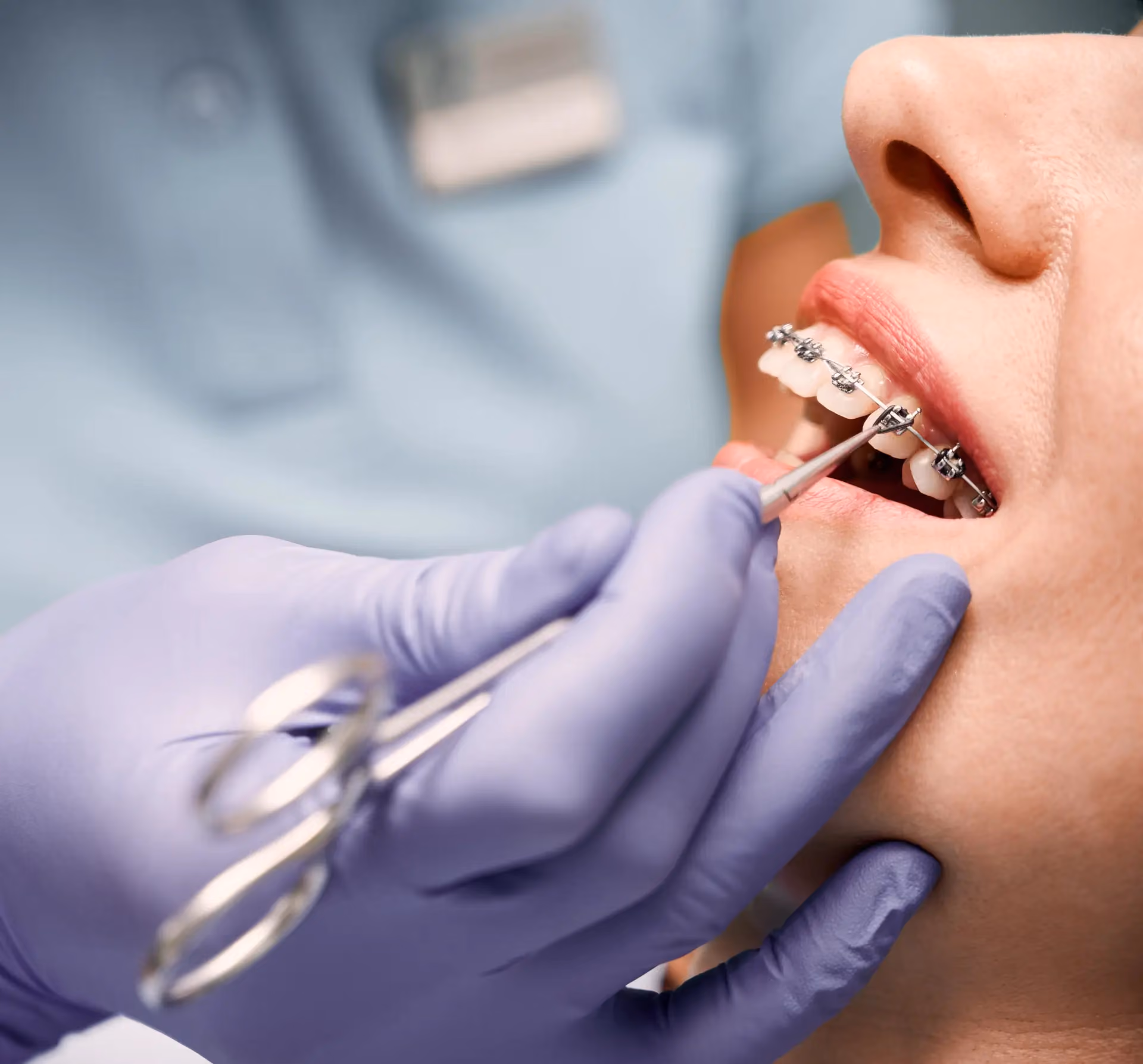 Braces Payment Plans | Lightning Orthodontics