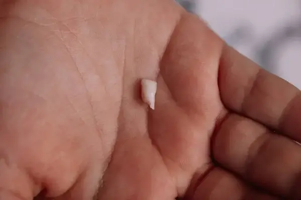 person holding tooth at the emergency dentist Charlotte NC