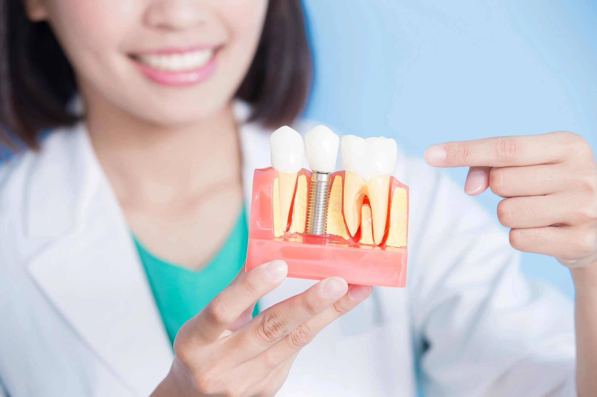 dentist Charlotte NC holding implant model