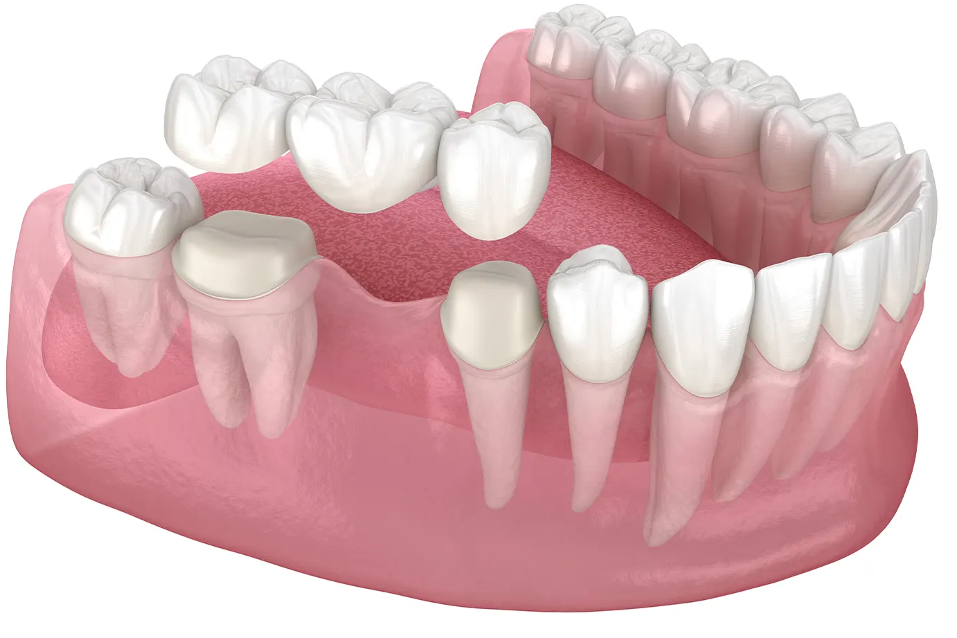 __wf_reserved_heredar