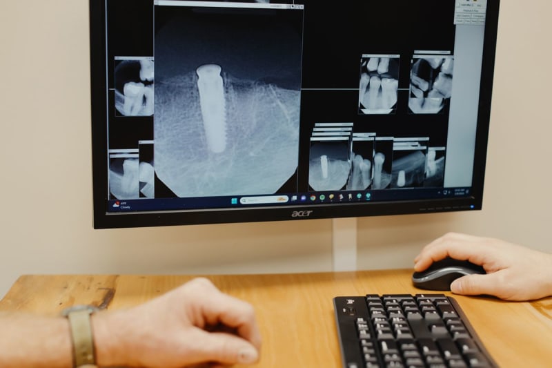 Close-up of dentist's hands pointing to dental X-ray displayed on computer monitor