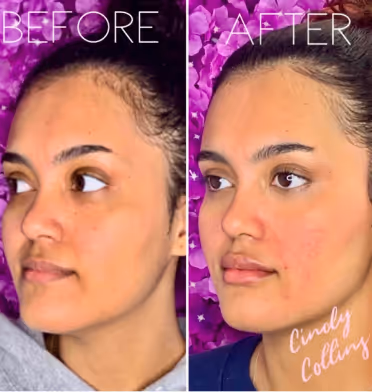 Before and after photo