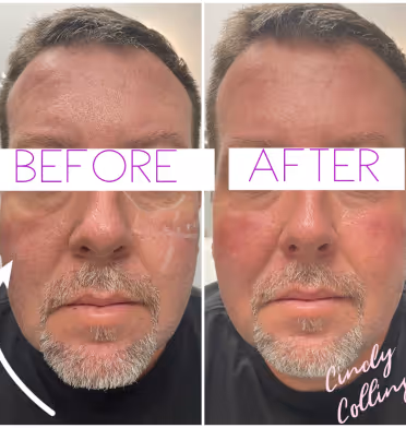 Before and after photo