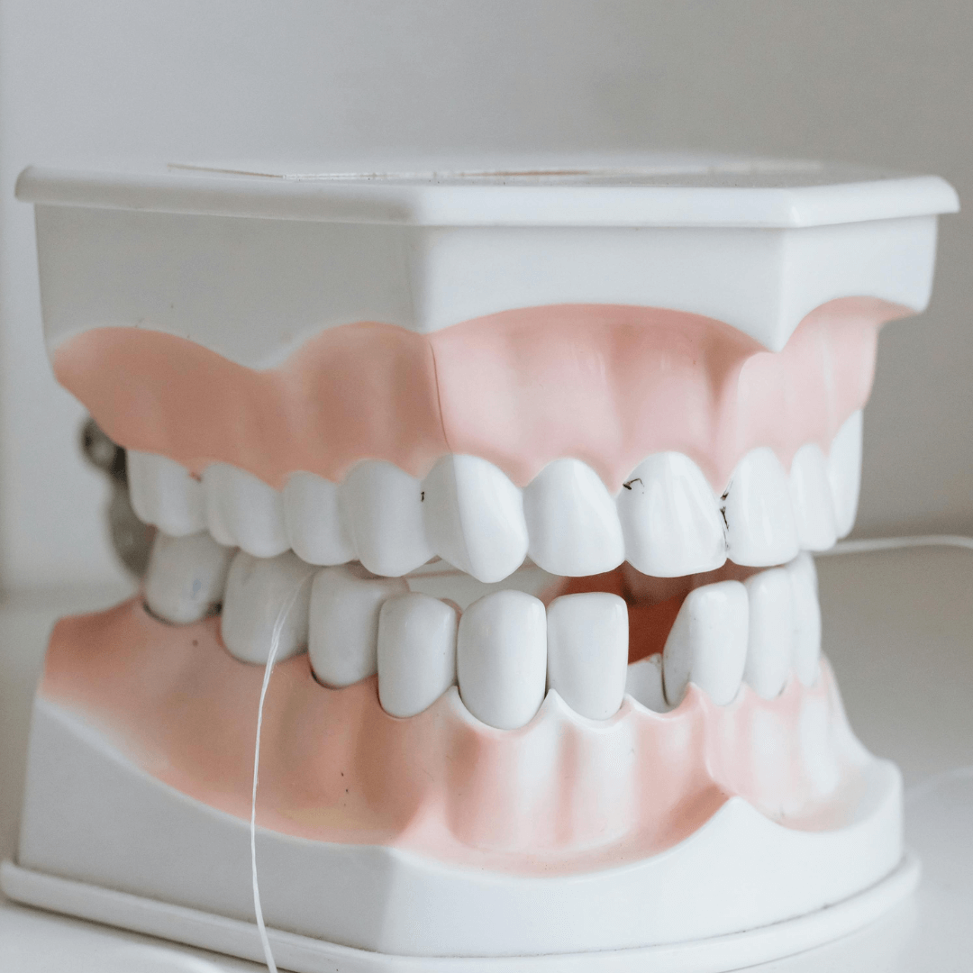 a model of teeth with dental floss