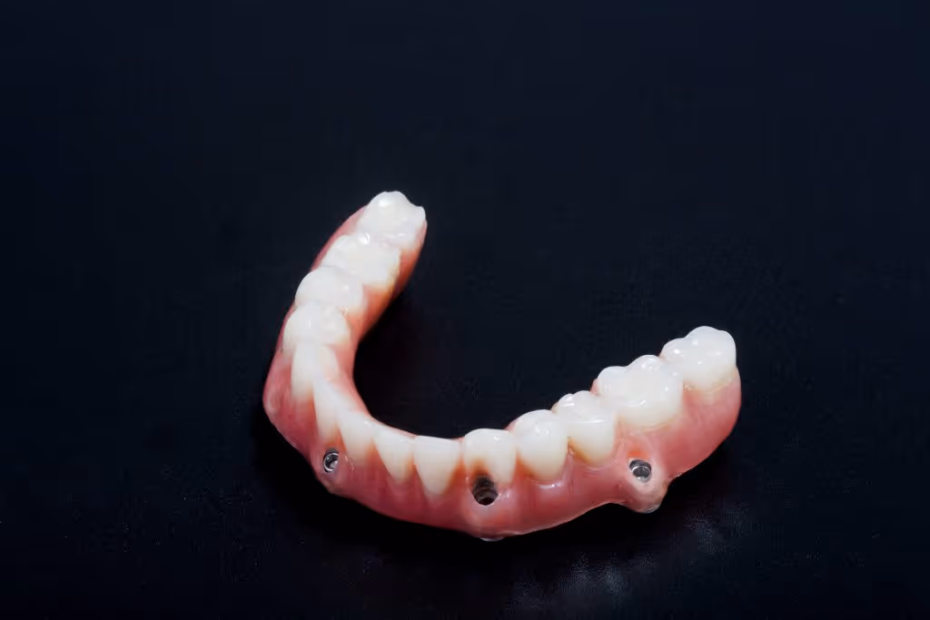 cuanto dura una prótesis dental