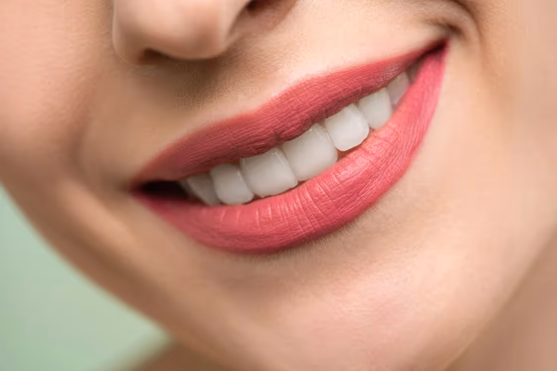 Sonrisa blanca