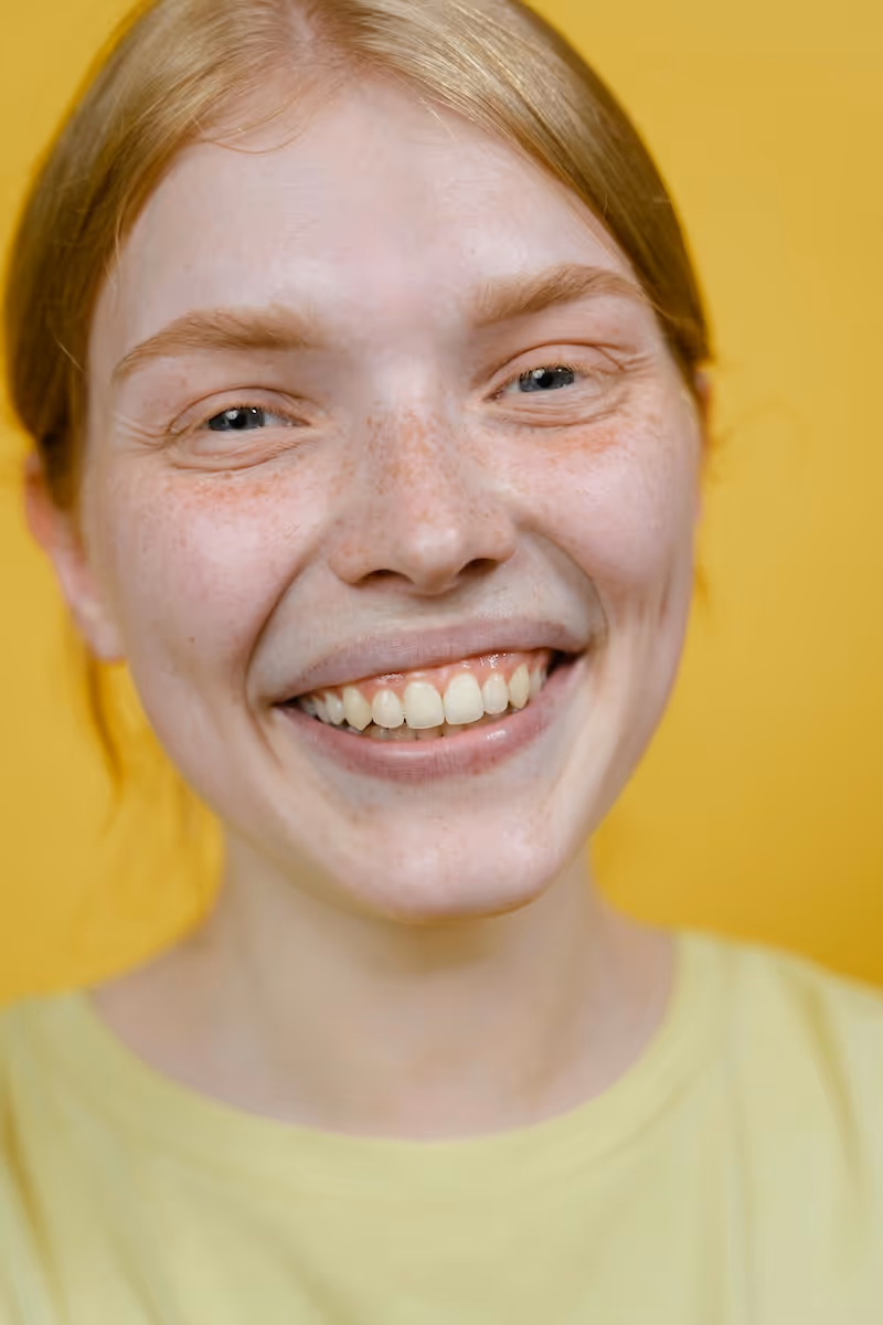 mujer sonriendo con sarro en los dientes