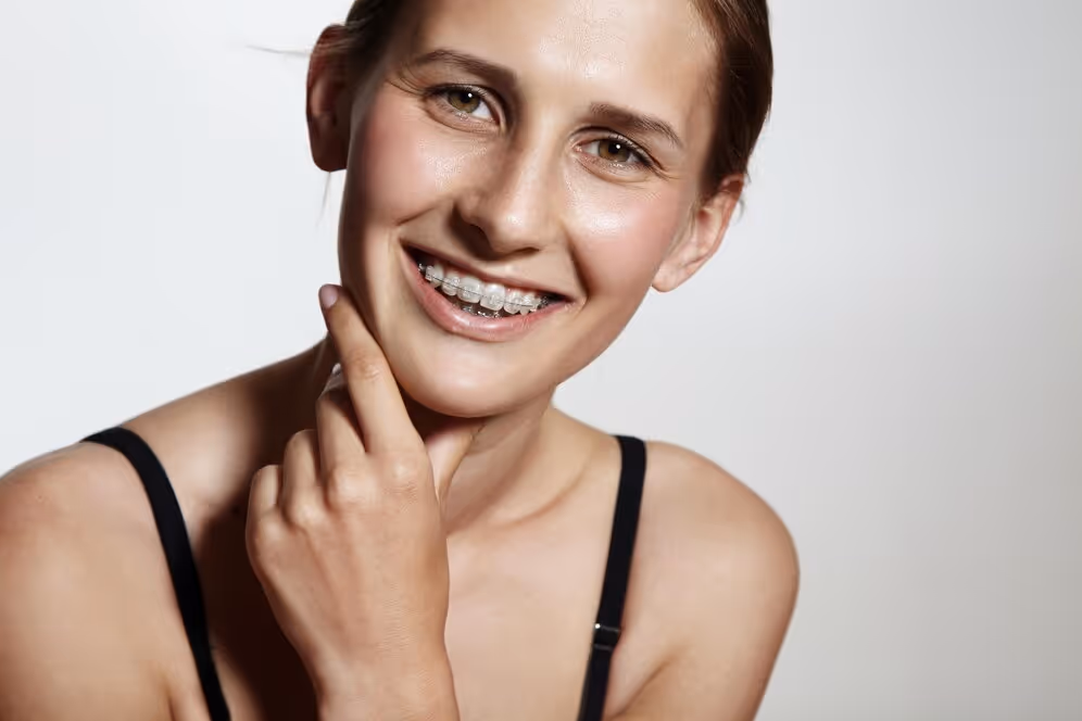 IMAGEN #2 Una chica feliz y sonriente con brackets de porcelana
