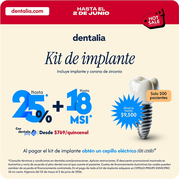 Implante (Incluye Tomografía, Implante de Titanio y Corona de zirconio)