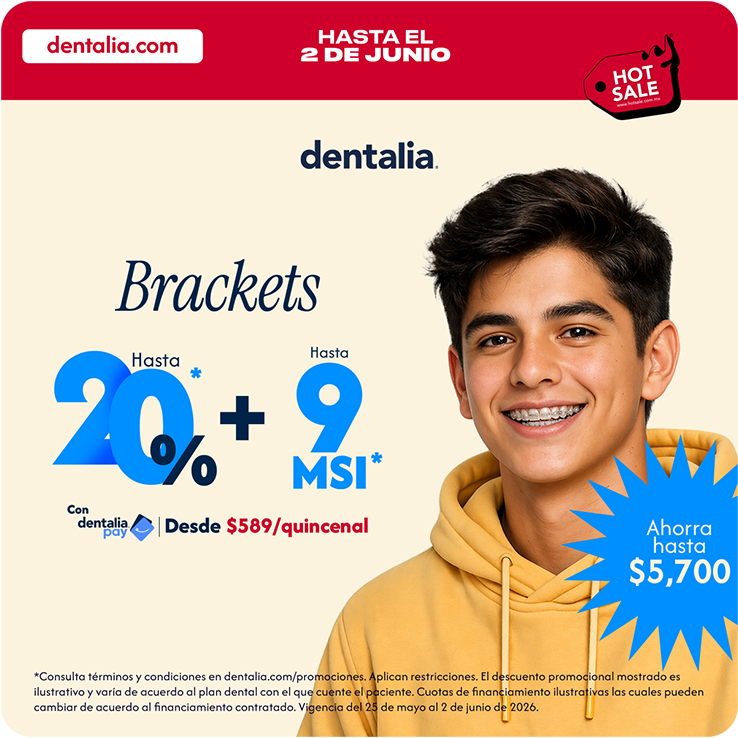 Brackets Autoligados y Estéticos