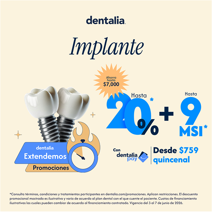 Implante (Incluye Tomografía, Implante de Titanio y Corona de zirconio)