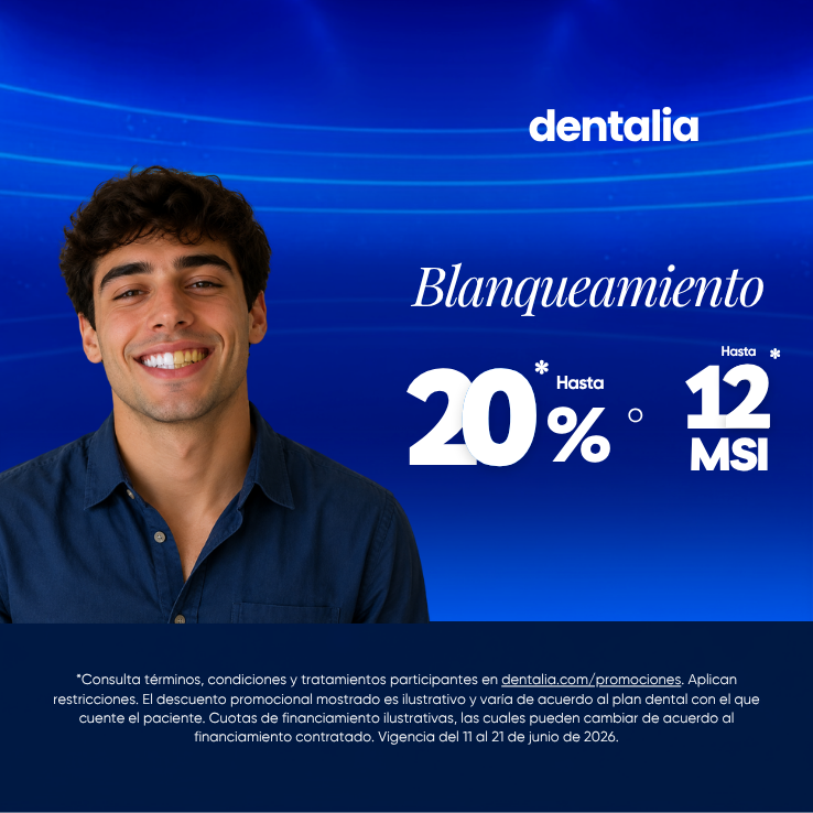 Promoción tiempo limitado