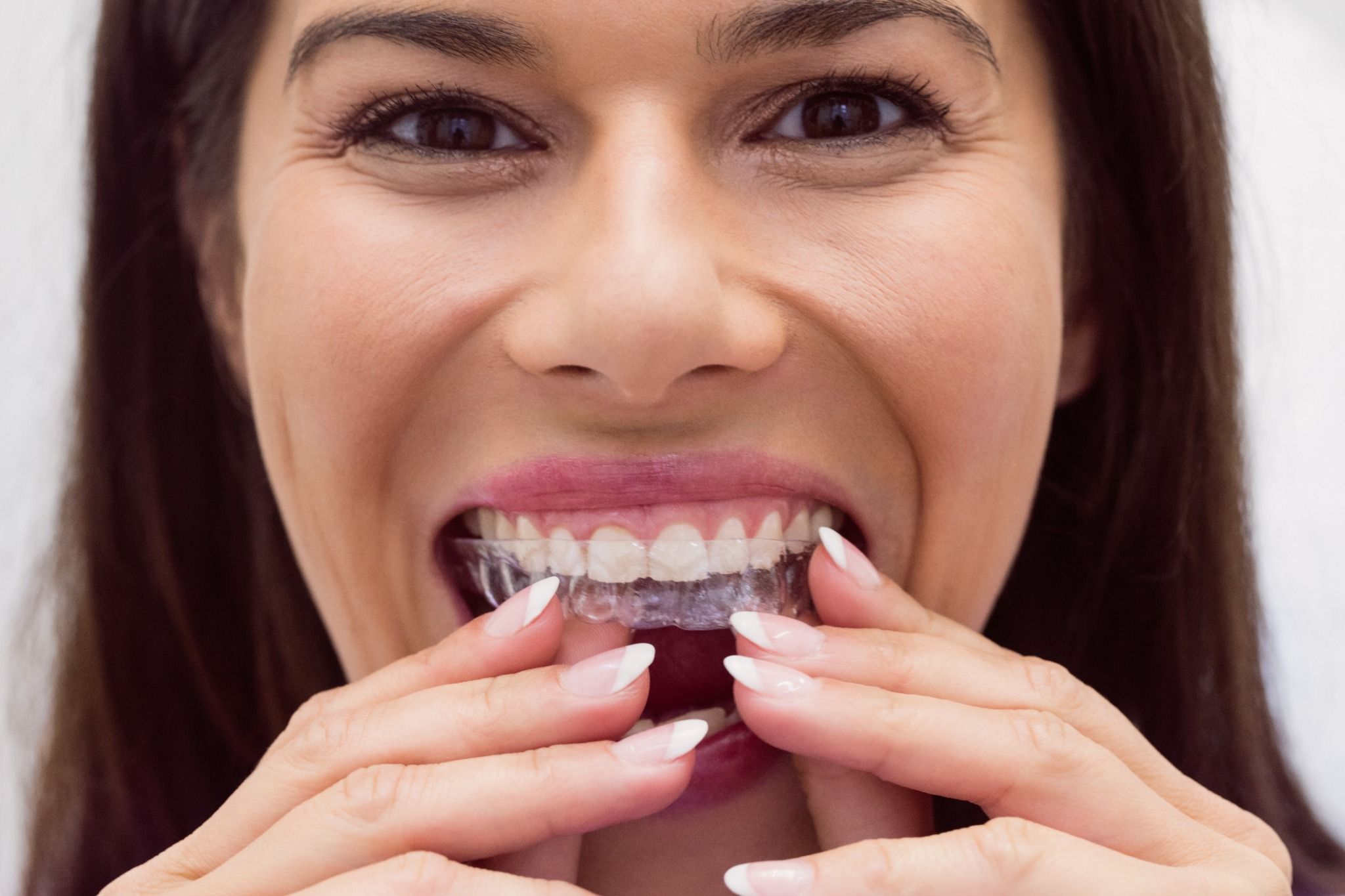 chica con invisalign