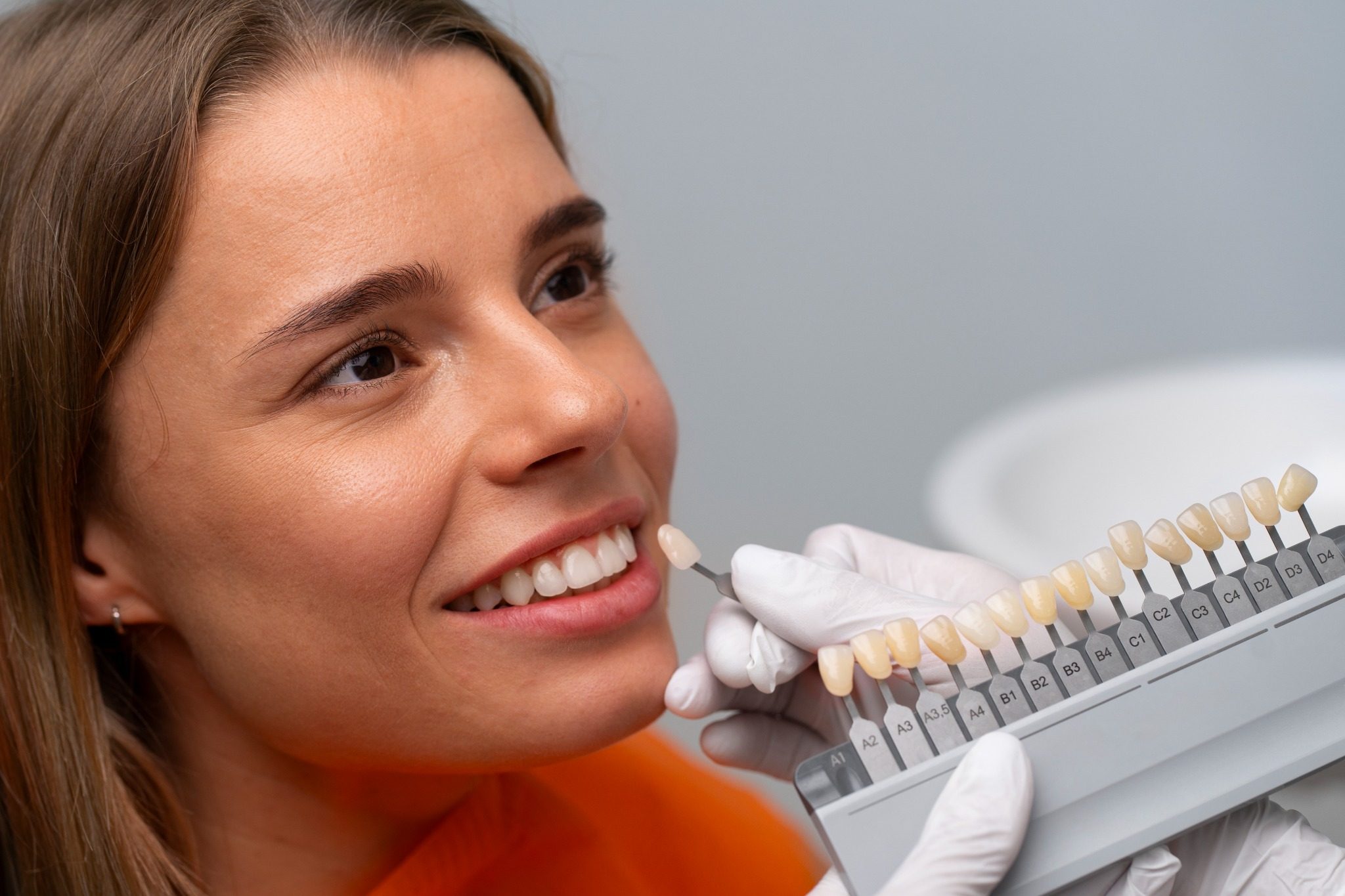 ¿Cómo se colocan las carillas dentales?