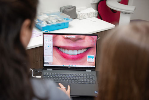 Custom smile design