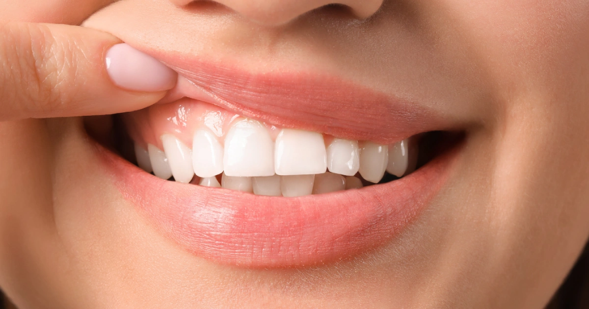 Can Hormonal Changes Affect Your Teeth and Gums?