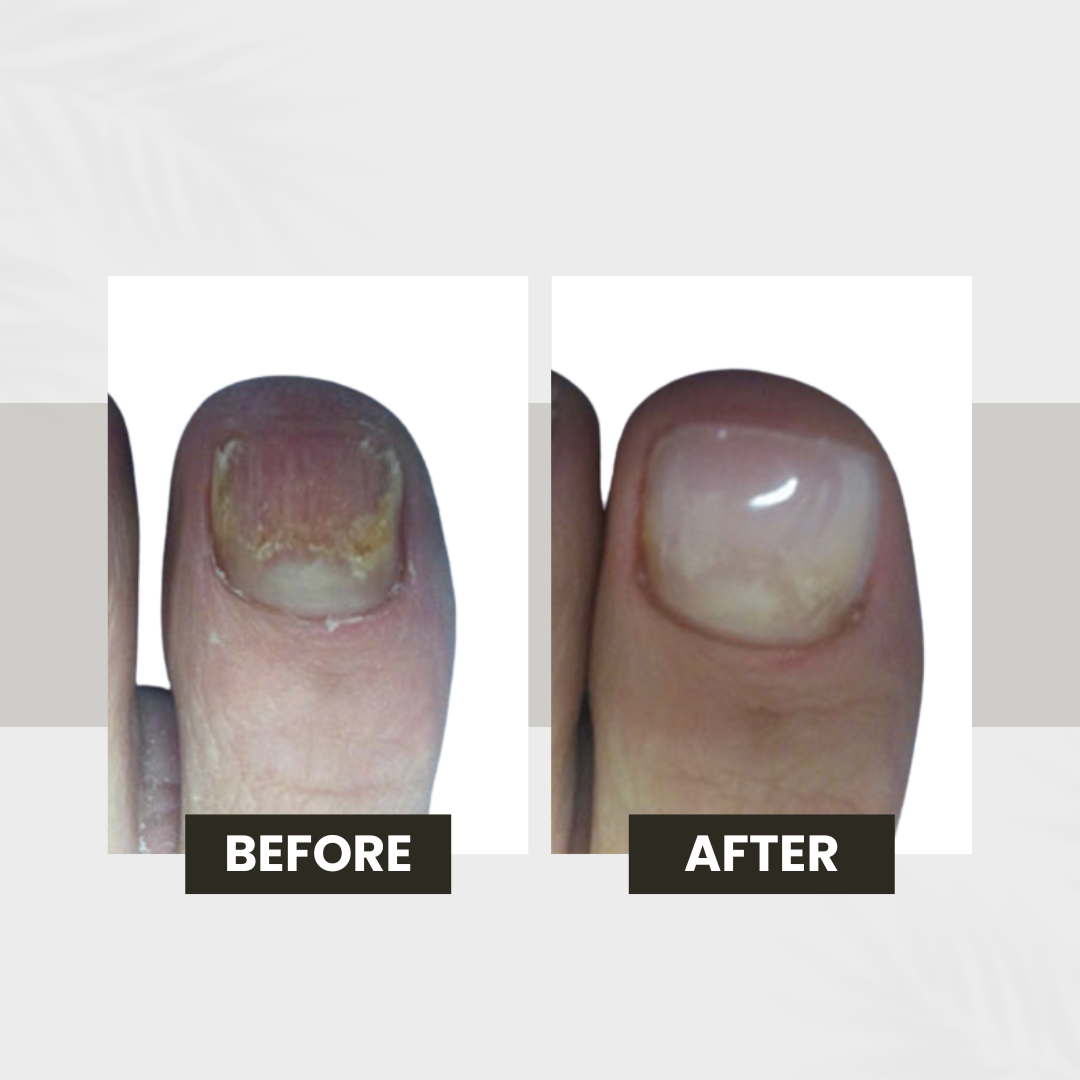 keryflex in bethesda,md and mclean,va