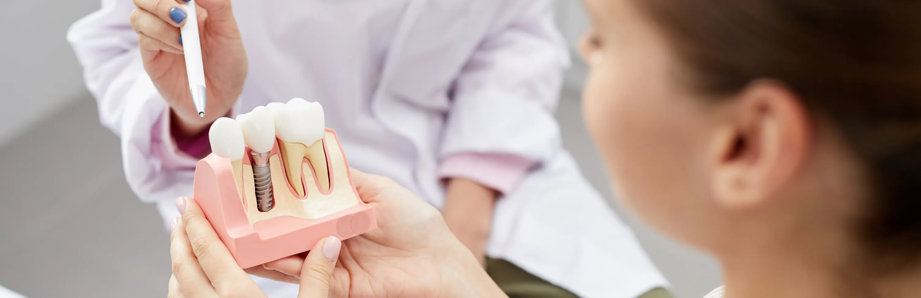 How to Maintain Your Dental Implants in Frisco, TX