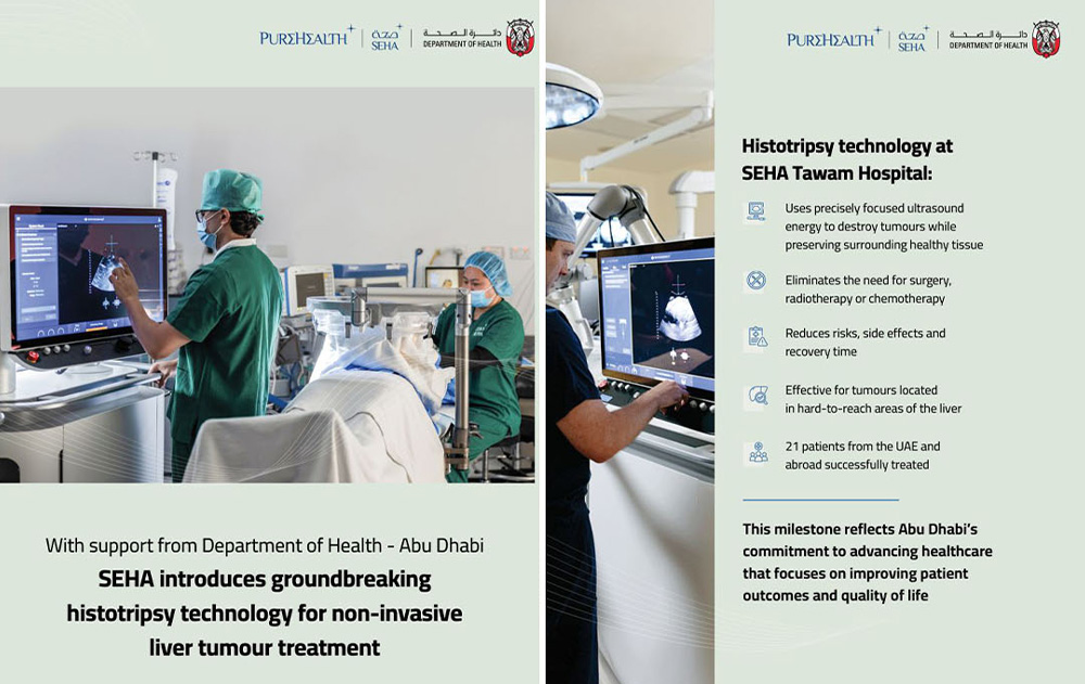 Histotripsy Technology at SEHA Tawam Hospital