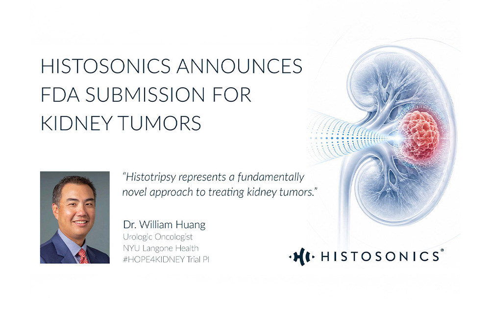 HistoSonics Submits FDA Request to Expand Edison Histotripsy System for Kidney Tumors