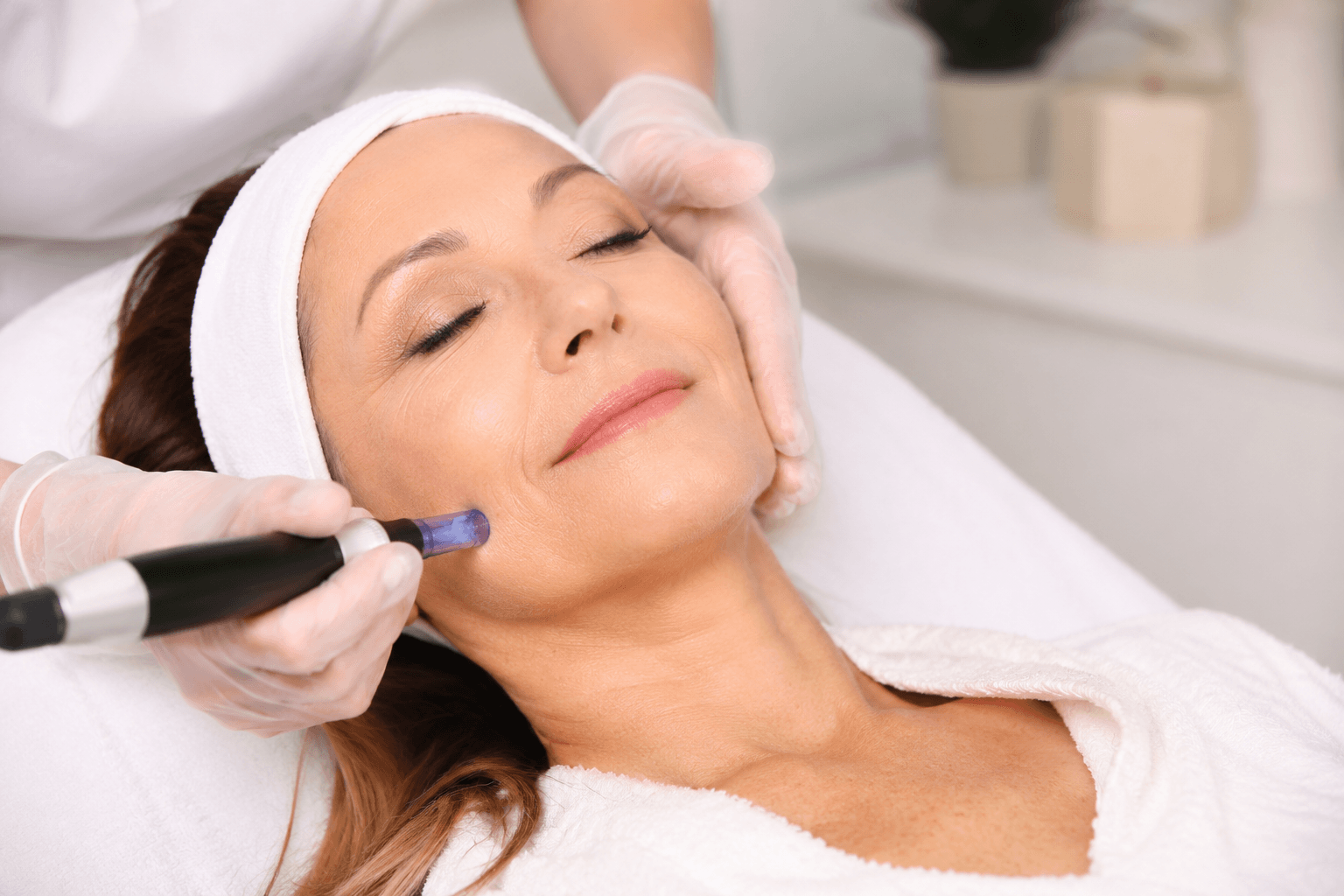 SkinPen microneedling treatment for crepey skin in McMurray, Pennsylvania medical spa office