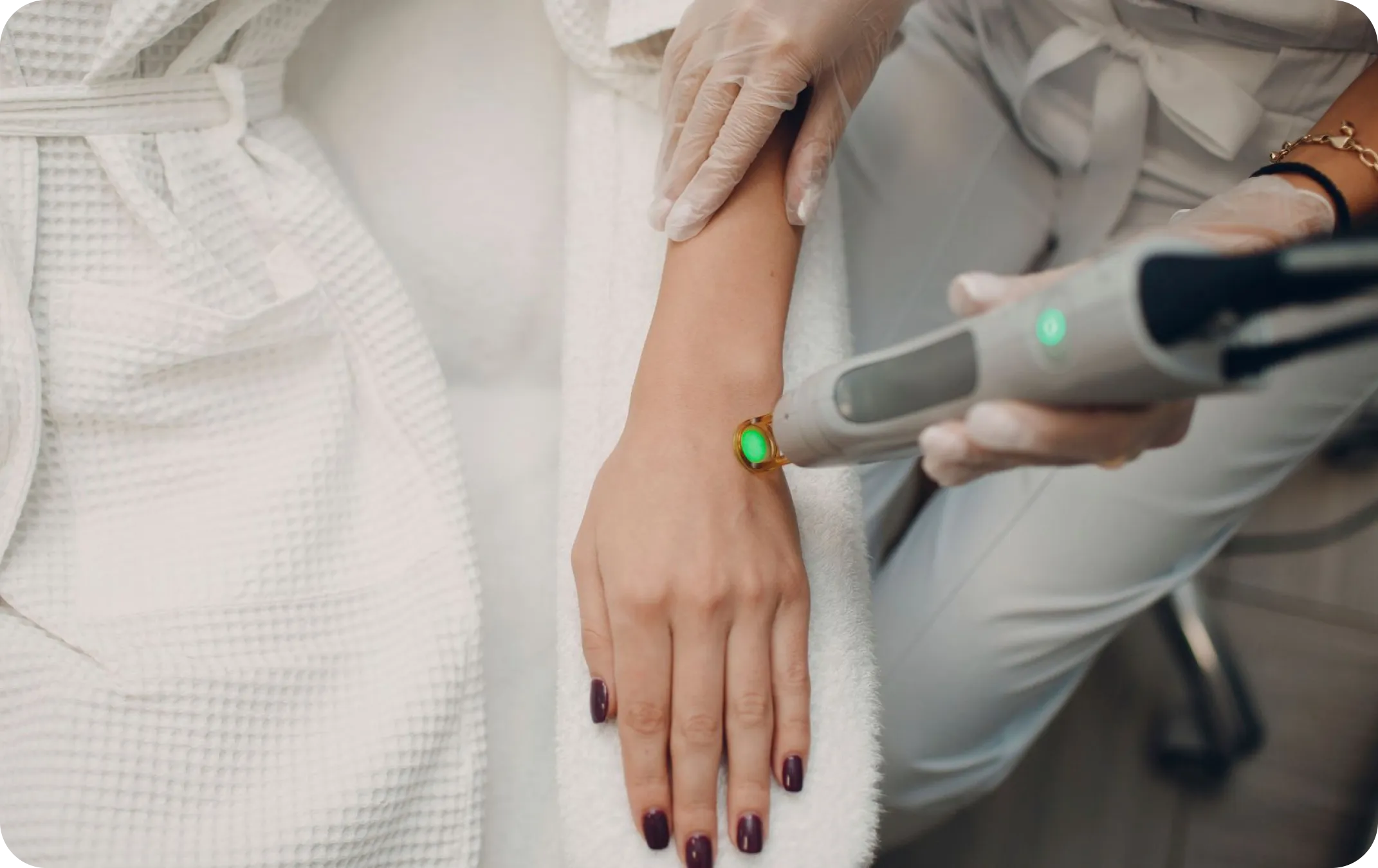 Permanent hair removal