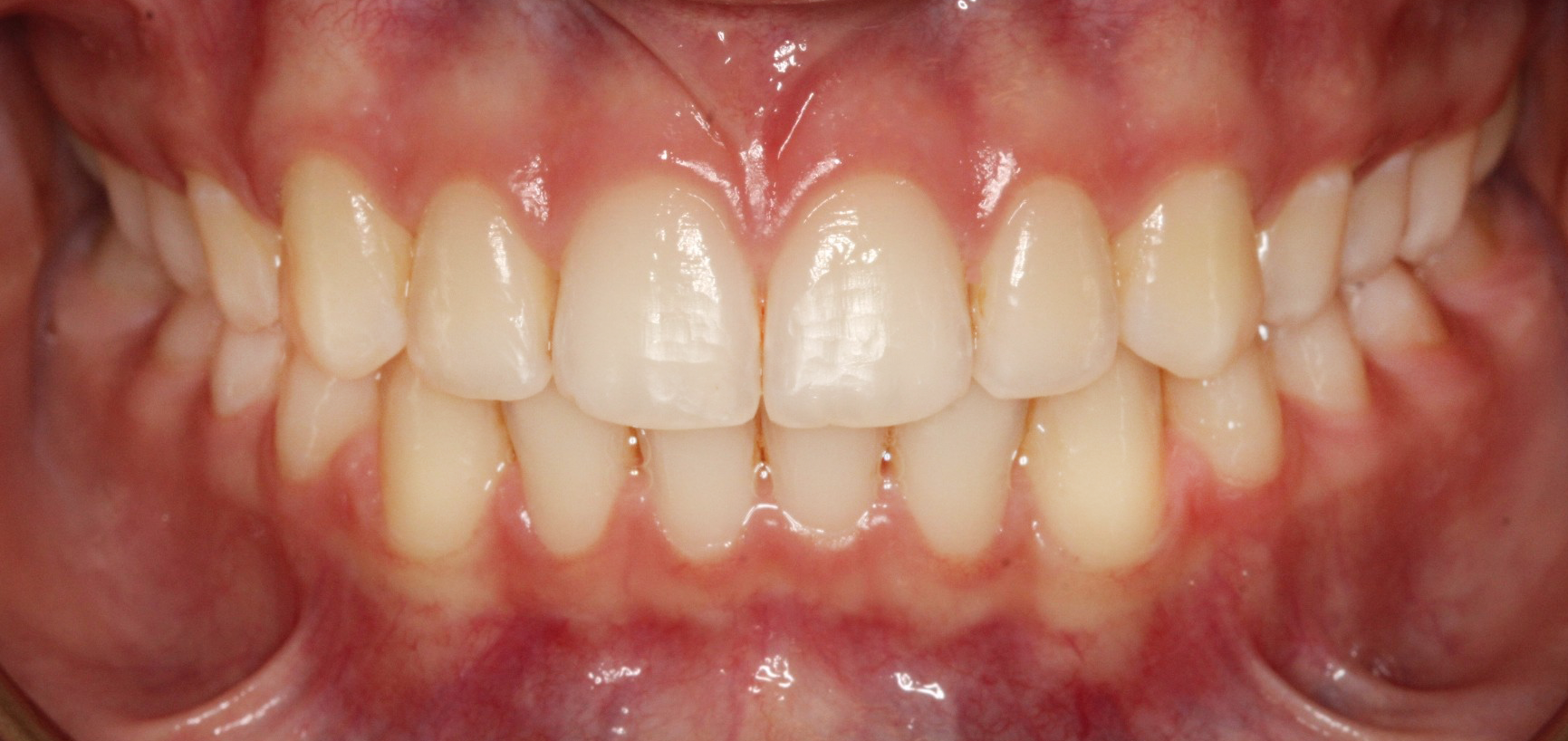 After Image