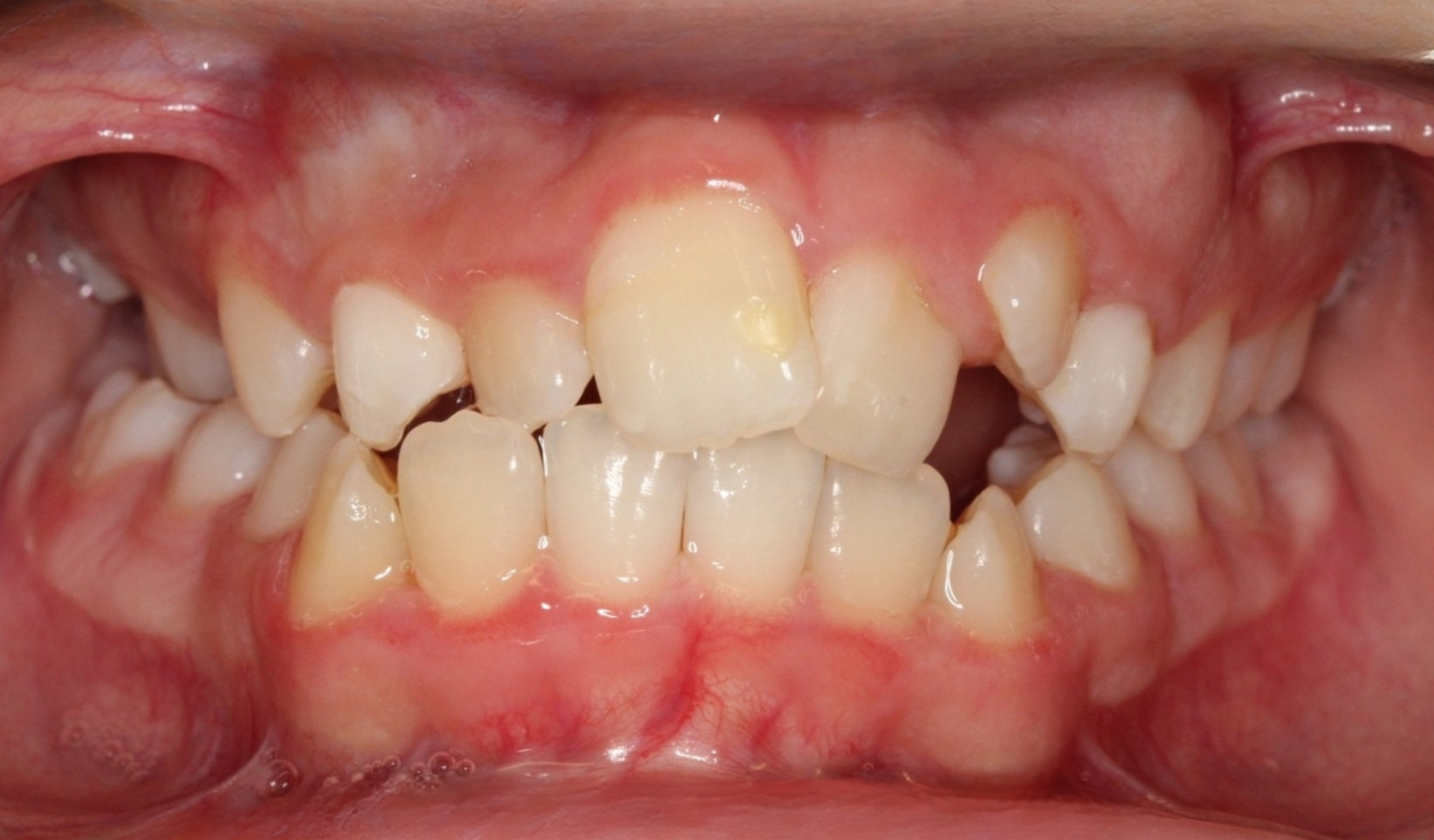 Before Image