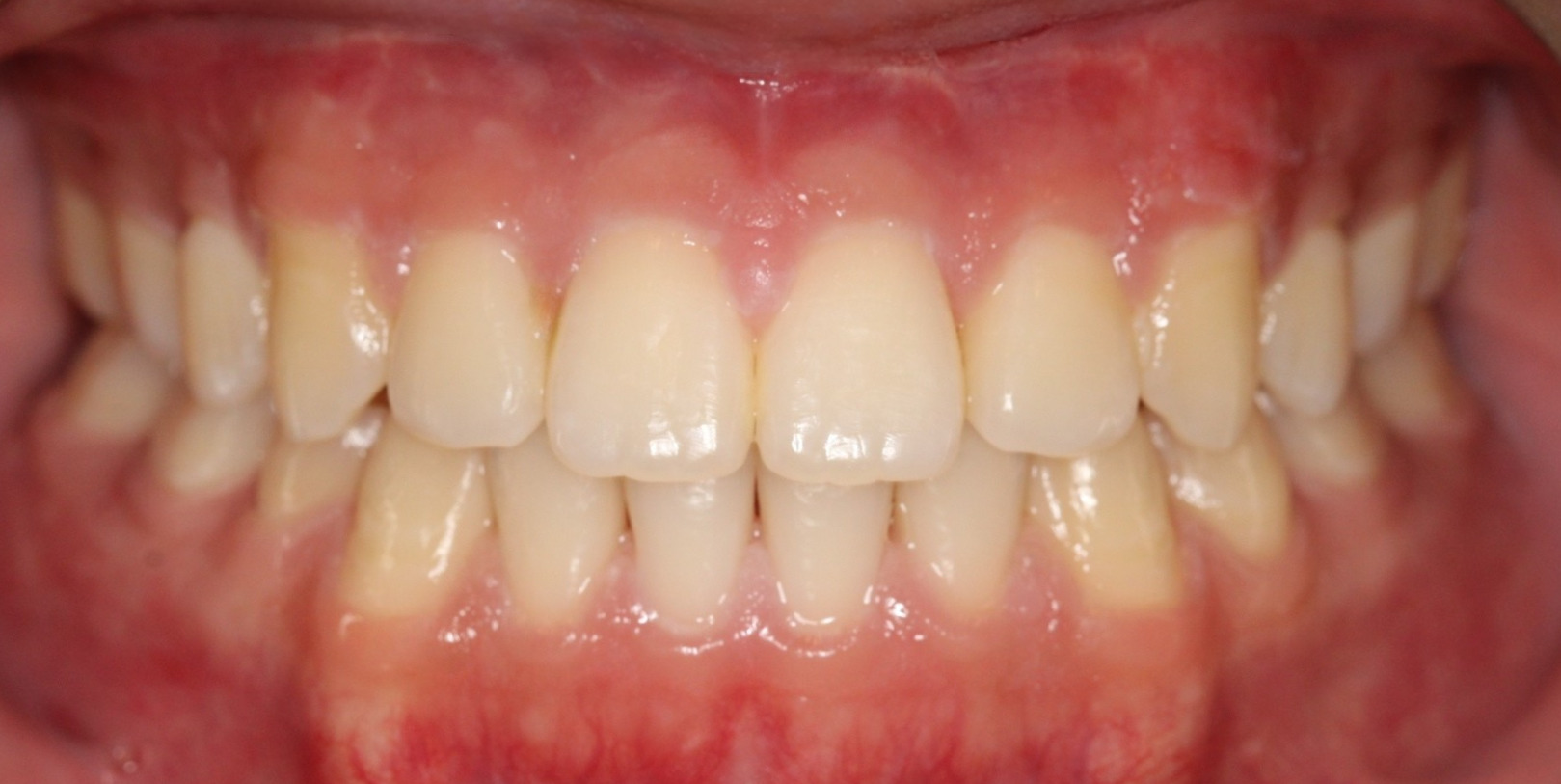 After Image