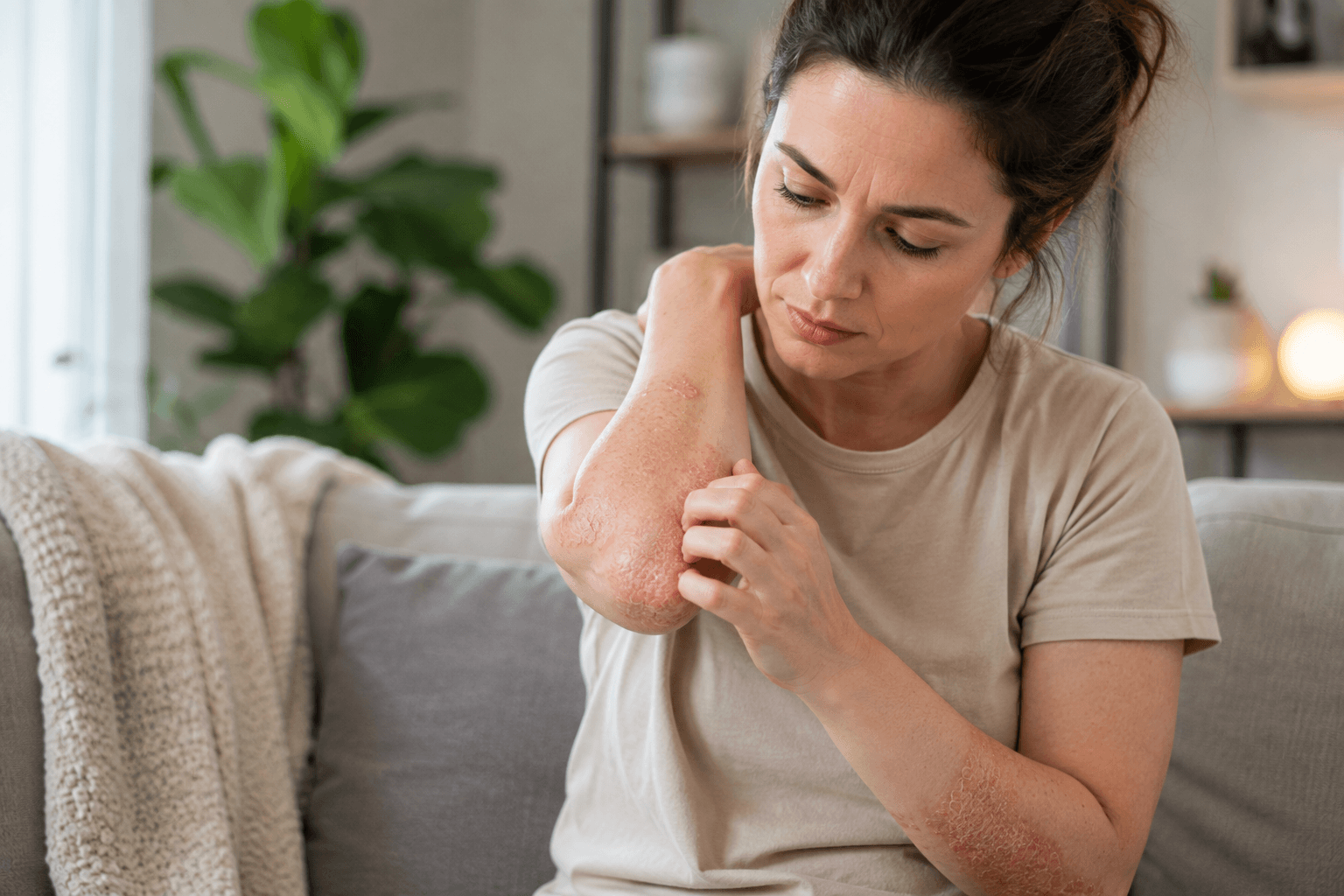Dermatologist examining psoriasis plaques on a patient's arm in Buckhead, Georgia