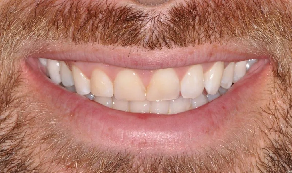 Before Image