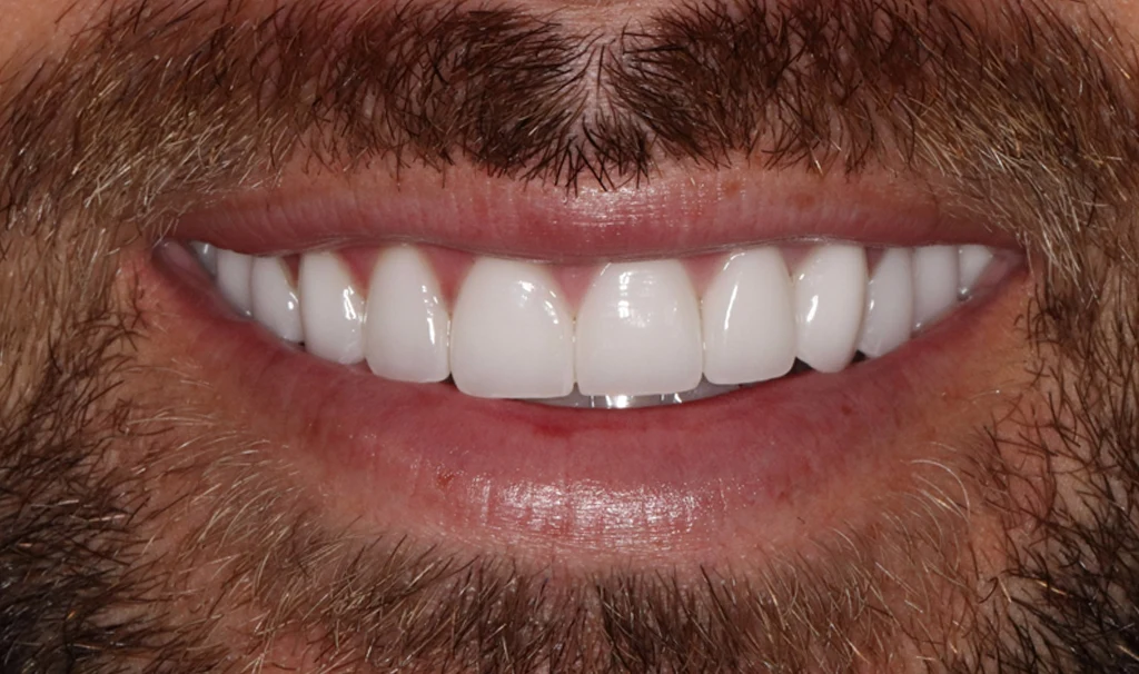 After Image