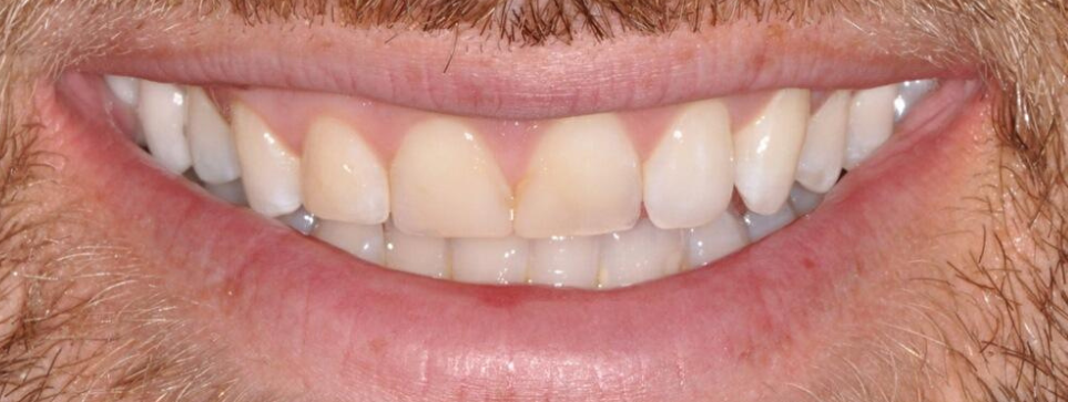 Before Image