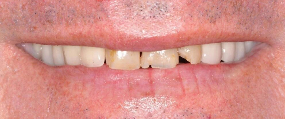 Before Image