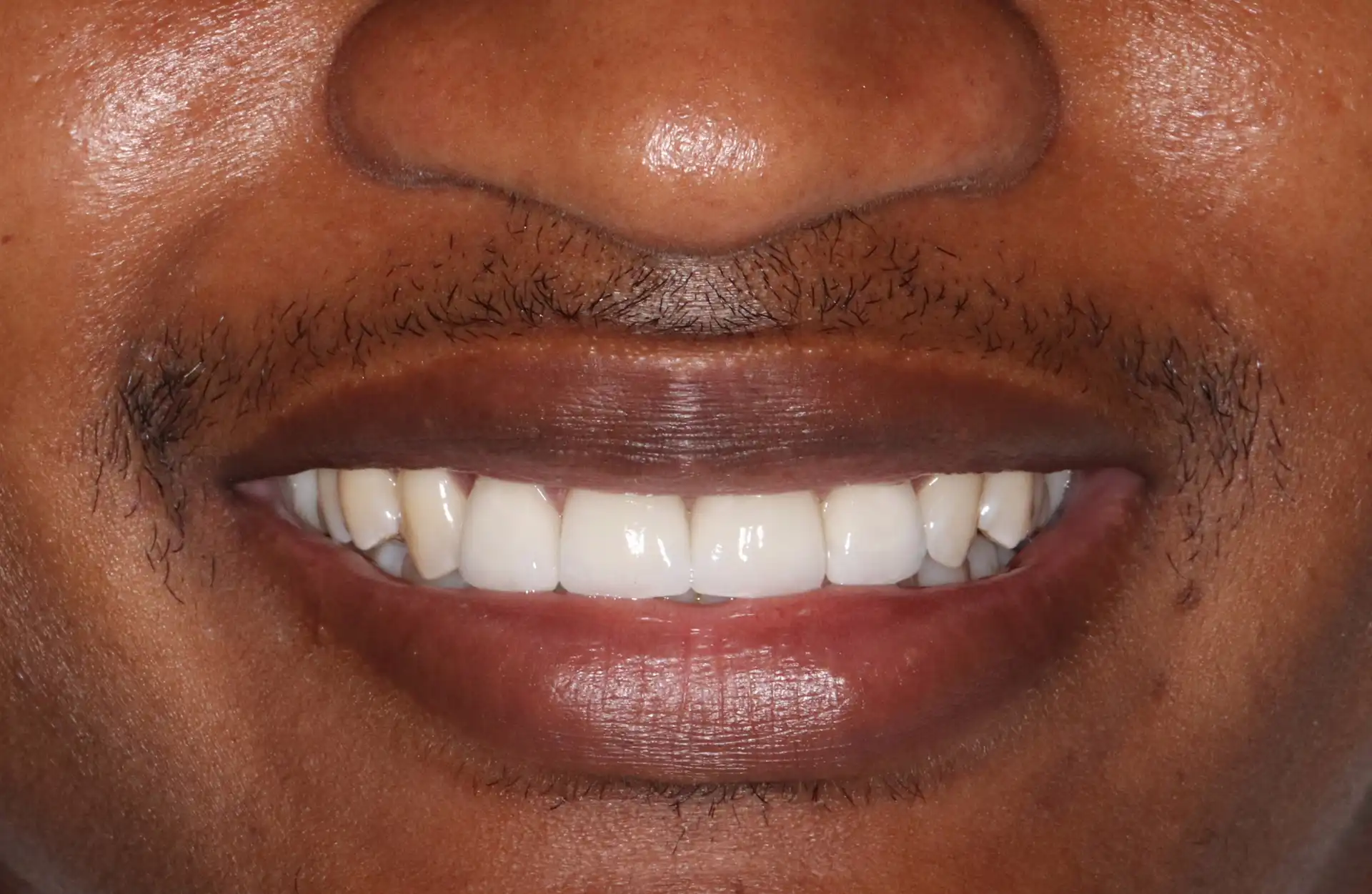 After Image
