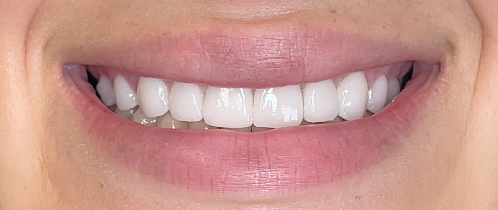After Image
