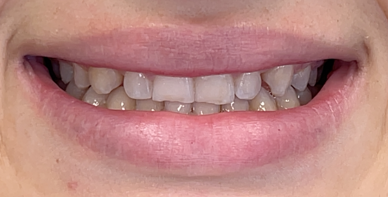 Before Image